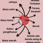 Dampak Mata Kering Jika Tidak Ditangani Lebih Dari Sekadar Ketidaknyamanan