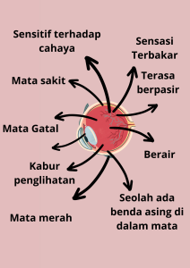 Dampak Mata Kering Jika Tidak Ditangani Lebih Dari Sekadar Ketidaknyamanan