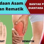 Menguak Perbedaan Asam Urat Ringan Dan Serius Panduan Lengkap Untuk Pemahaman Dan Penanganan